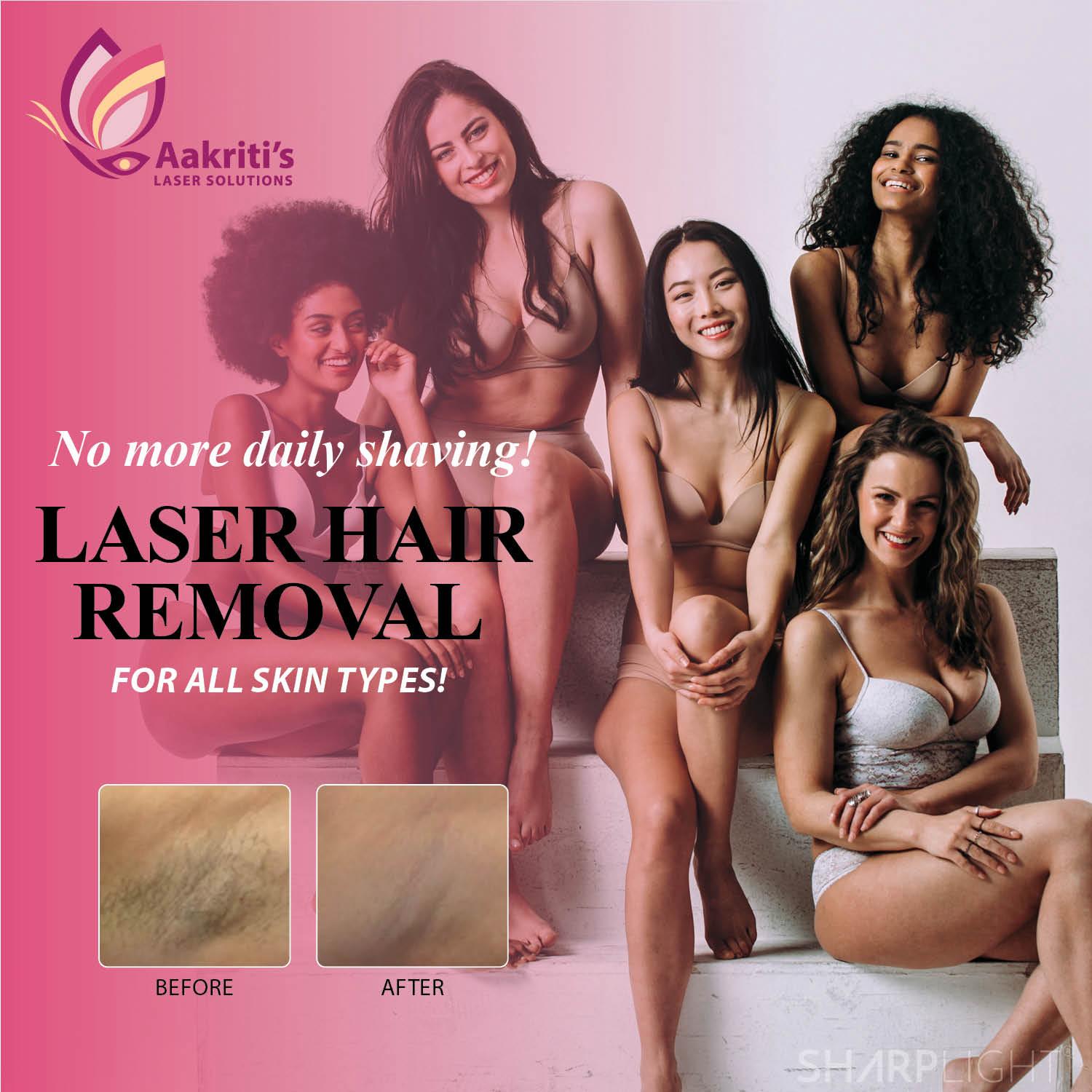 Facial Laser